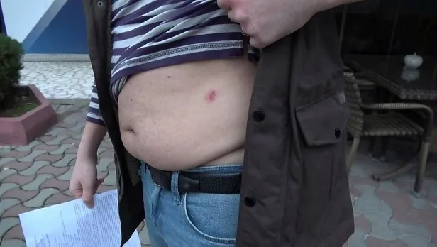 Doktor karı-kocanın 'korona' tartışması karakolda bitti: 'Ben pozitif oldum, sen de pozitif olacaksın' diyerek yüzüme tükürdü"-3