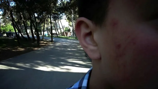 Tuzla'da magandanın öldüresiye dövdüğü çocuk o anları anlattı-3