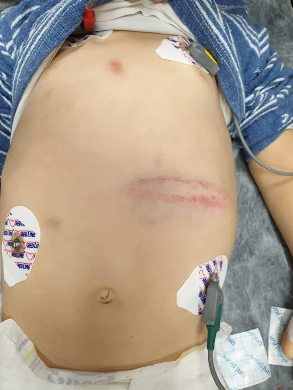 Adana'da isyan ettiren olay! 'Üzerine motosiklet düştü' denilmişti, gerçek ortaya çıktı-6