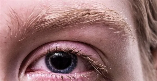 Keskin gözler için sofranızda olması gerekenler