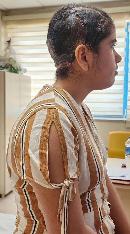 antalyada-go-kart-faciasi-saci-tekerlege-dolaninca-kafa-derisi-yerinden-siyrildi-1694360044411.jpeg Antalya'da Go-kart faciası! Saçı tekerleğe dolanınca kafa derisi yerinden sıyrıldı: Genç kız ölümden döndü-6