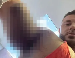 Ağırlık çalışırken göğüs kasları kopup yerinden fırladı!