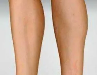 Bu Ayakkabıları Giyer miydiniz?