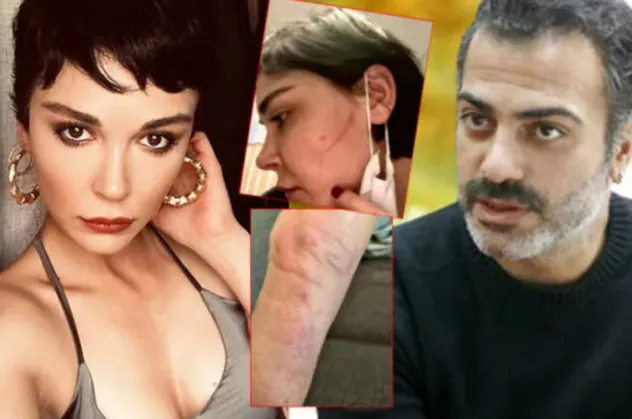 Eşkıya'nın Esra'sı Sevcan Yaşar ve Sermiyan Midyat'ın darp olayındaki görüntüler kan kondurdu! 'Çıplak görüntülerimi çekti' demişti