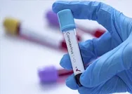 Koronavirüs aşısı ne zaman bulunacak? Bilim Kurulu üyesi Prof. Dr. Ateş Kara tarih verdi