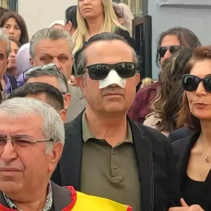 Okul bahçesinde öğretmene kafa attı