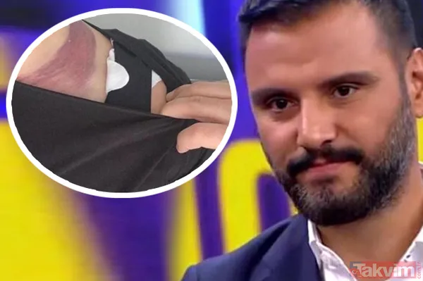 Alişan ölümden döndü soluğu eşiyle birlikte mahkemede aldı! Alişan'ın 12 milyonluk 'yağ aldırma' davasında her yeri mosmor olmuştu - 2