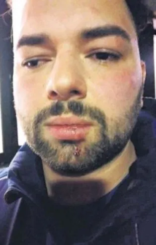 Almanya'da iş adamı Yüksel Aker'e polis şiddeti!