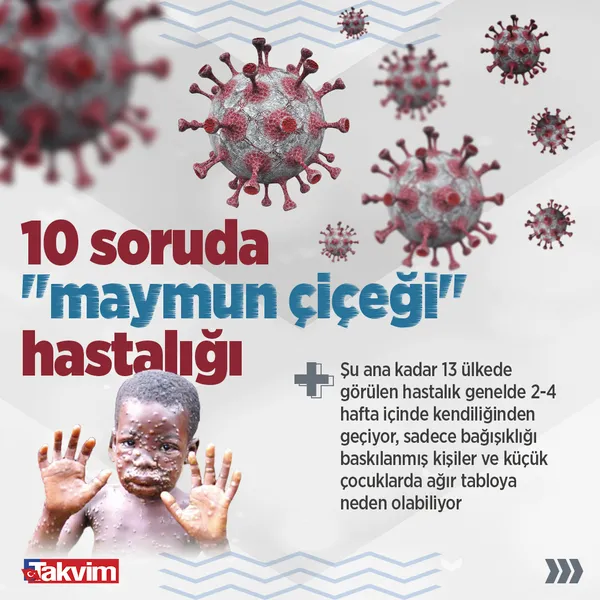 SON DAKİKA! Bakan Koca'dan flaş maymun çiçeği açıklaması! Türkiye'de ilk vaka! Maymun çiçeği hangi ilde görüldü?-8