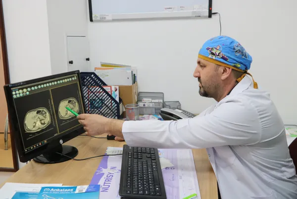 zonguldakta-47-yasindaki-kadin-hastanin-safra-kesesinden-1250-tane-tas-cikti-doktor-taslarla-kendi-adini-yazdi-1652767041544.jpg Zonguldak'ta 47 yaşındaki kadın hastanın safra kesesinden 1250 tane taş çıktı! Doktor taşlarla kendi adını yazdı-4