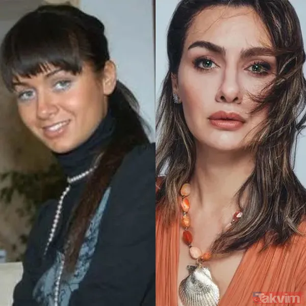 Yeşilçam’ın Sultan’ı Türkan Şoray'ın kızı Yağmur Ünal’ın son haline bakın! Botokstan konuşamadı! Gören şaştı kaldı - 14