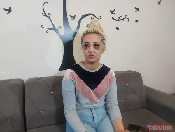 Eski sevgilisine dehşeti yaşattı: Ayrılmayı kabul etmedi 3 saat boyunca darp ederek tanınmaz hale getirdi! - 4