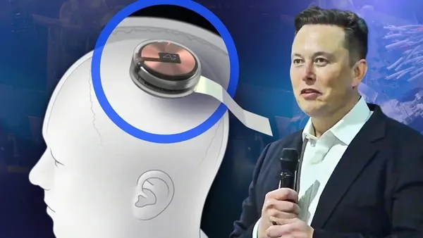Elon Musk insanlara çip takacak: Neuralink çip tartışma konusu-8