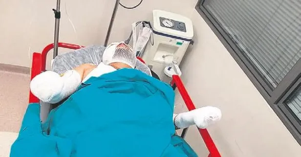 Evi yakmak isterken kendilerini yaktılar