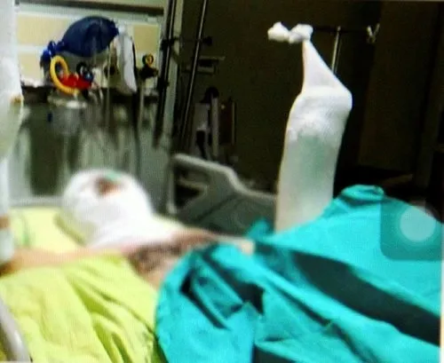 CHP’li Ataşehir belediyesinde işçi kendisini yaktı! CHP'li ismin sözleri şoke etti-1