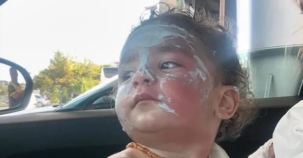 Adana'da feci olay! 1,5 yaşındaki bebeğin üzerine kahve döküldü