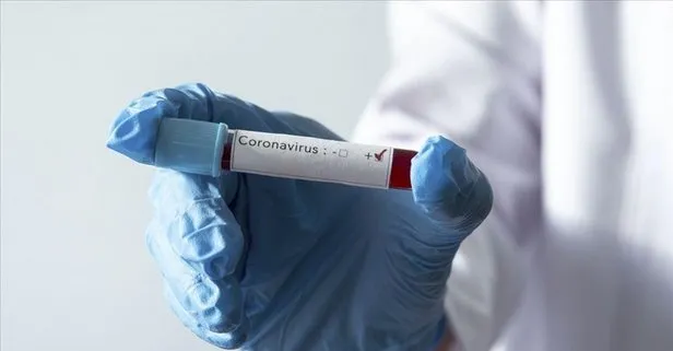 Koronavirüs can almaya devam ediyor! Şili’de Kovid-19 nedeniyle ilk ölüm gerçekleşti