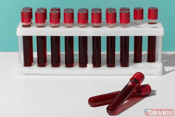 💡 Kan Grubu Ve Kişilik İlişkisi: Bilim Ne Diyor? Dr. Masaru Tanaka (Kanagawa Üniversitesi, Biyopsikoloji Uzmanı) Bu Konuda Şunları Söylüyor: "Bireylerin Kan...