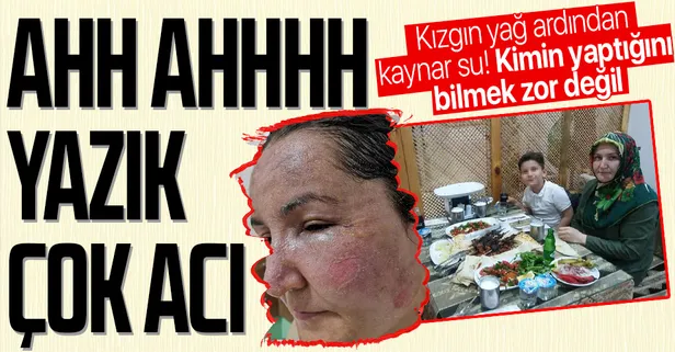 Çocuklarının gözü önünde eşini kızgın yağ ve kaynar suyla haşlayan koca tutuklandı