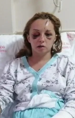 5 gün sonra yoğun bakımdan çıktı: İfadesi kan dondurdu