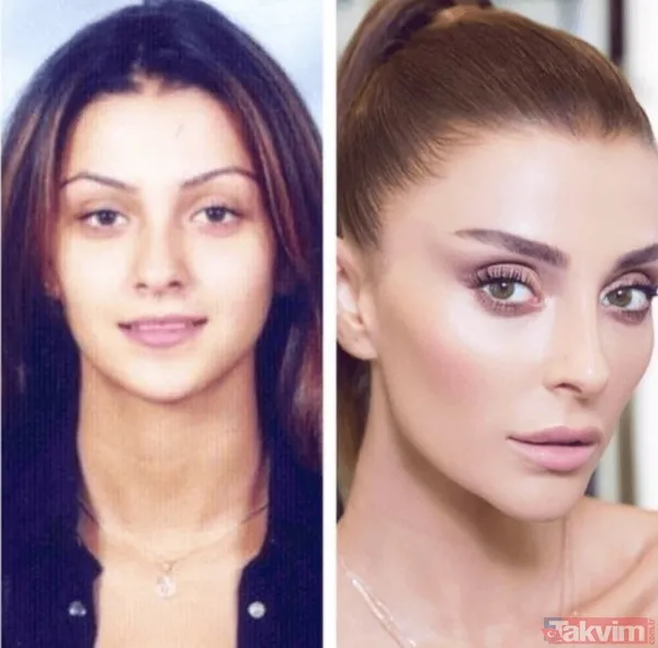 Esra Bilgiç estetik harikası çıktı! Eski halini görenin gözleri fal taşı gibi açıldı: Doğal sanıyordum! Diriliş Ertuğrul’un yıldızı... - 18