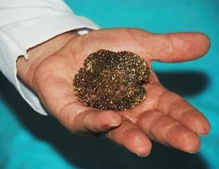 Mesanesinden çıkan şey şaşkına çevirdi