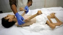 İsrail 13 yaşındaki Abdulkadir es-Serhi’yi açlıktan öldürdü!