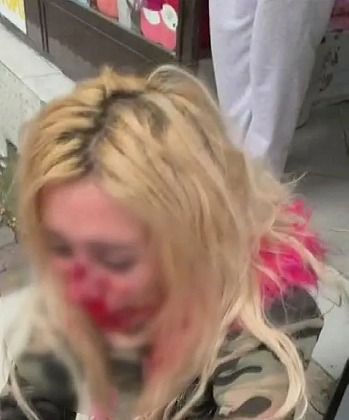 SON DAKİKA: Gaziosmanpaşa'da dehşet: Kadına kafa atarak kanlar içinde bıraktı-2