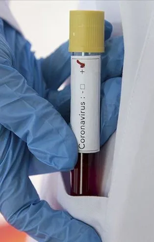 Etiyopya'da seçimlere koranavirüs engeli