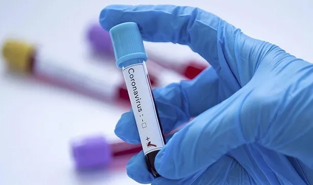 son-dakika-saglik-bakani-fahrettin-koca-illere-gore-haftalik-vaka-haritasini-acikladi-30-ekim-2021-5-kasim-2021-1636820217481.jpeg Son dakika: Sağlık Bakanı Fahrettin Koca illere göre haftalık vaka haritasını açıkladı (30 Ekim 2021 - 5 Kasım 2021)-7