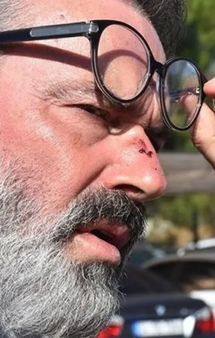 Murat Başoğlu Amerika'ya kaçmak istiyor!