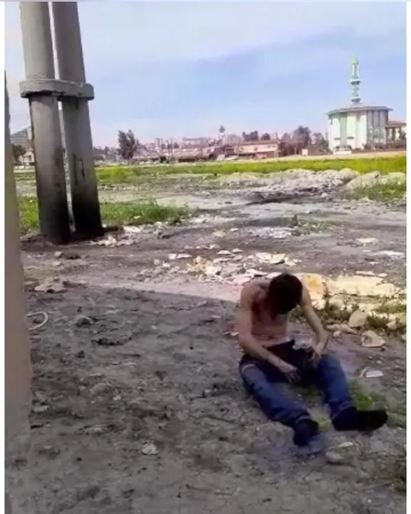 akima-kapilan-gencin-yardim-cigligi-oluyorum-yaniyorum-soyle-cabuk-gelsinler-1648022186184.jpg Akıma kapılan gencin yardım çığlığı: Ölüyorum, yanıyorum, söyle çabuk gelsinler-2