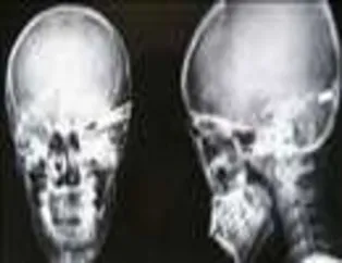 İnanılmaz röntgen filmleri