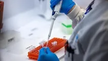 Sağlık Yetkilileri Alarma Geçti! Ebola Benzeri Virüs Temas Yoluyla Bulaşıyor, Yüksek Ölüm Oranına Sahip