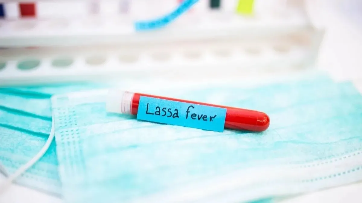 Photo: takvim.com.tr Lassa Fever Outbreak in Nigeria: Death Toll Rises to 237 as Cases Hit 1,000