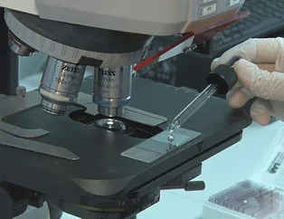 Türkiye’de bir ilk olacak! O sorunun tedavisinde kesin çözüm