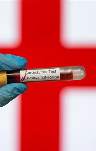 İngiltere'de koronavirüs kabusu! Ölü sayısı artmaya devam ediyor