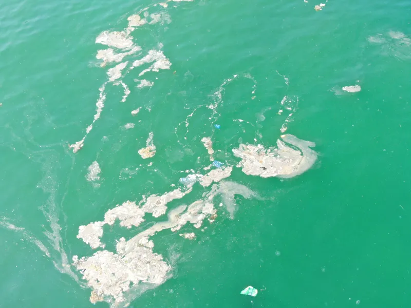 Müsilaj yine hortladı! Çocuğunuzda kusma ve ishal varsa dikkat! Uzman isimden flaş uyarı-5