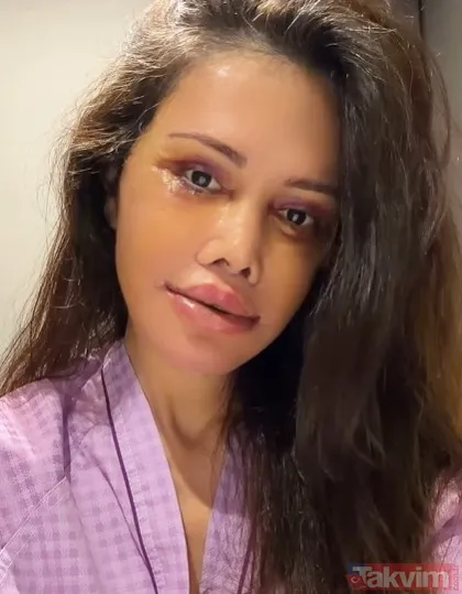 Eski Survivor yarışmacısı Didem Ceran Güney Kore'de 15 saatlik "yüz nakli" operasyonu geçirdi - 2