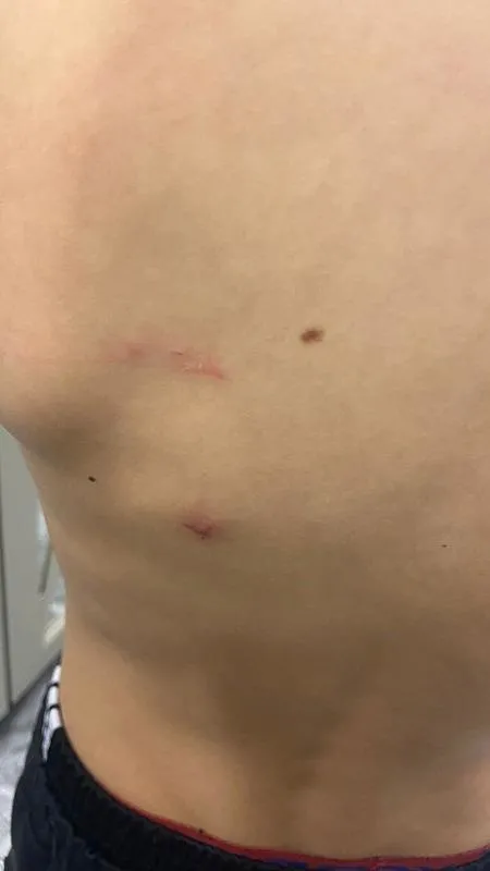 basaksehirde-okul-mudurunun-besledigi-kopekler-ogrenciye-saldirdi-1716370933510.jpeg Başakşehir'de okul müdürünün beslediği köpekler öğrenciye saldırdı-4