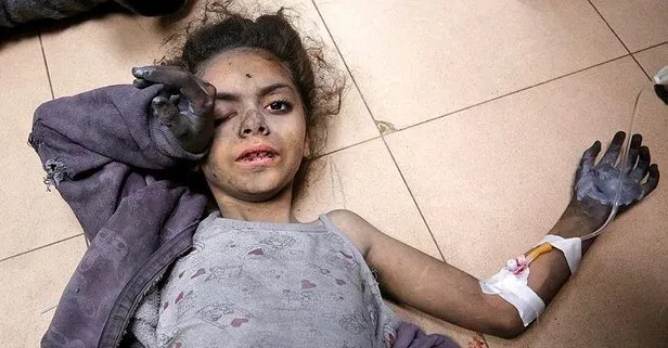 Katil İsrail’in saldırılarını sürdürdüğü Gazze’deki imkansızlıklar nedeniyle salgın felaketi yaşanıyor: 2 yılı geçti!