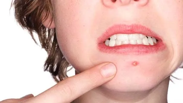 Karaciğer Alzheimer’dan korur, yoğurt saç dökülmesini engeller-3