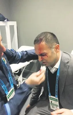 Çetinkaya’nın başı yarıldı