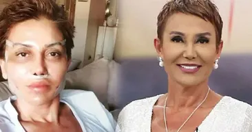 Serap Paköz başını fena halde ağrıtan estetik sonrası son haliyle bambaşka biri! Seda Sayanın ipiyle kuyuya inmişti kimse tanıyamıyor