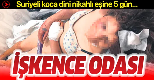 Suriyeli dini nikahlı kocadan işkence odası