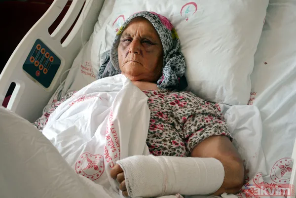 Kendisine para vermeyen anne ve babasını 2 saat boyunca baston koltuk değneği ve balta sapıyla dövdü - 2