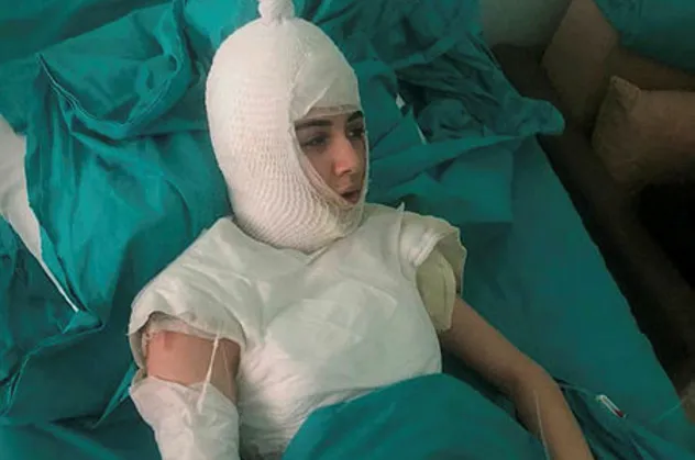 Üvey anne dehşeti! Başından aşağı kaynar su döktü