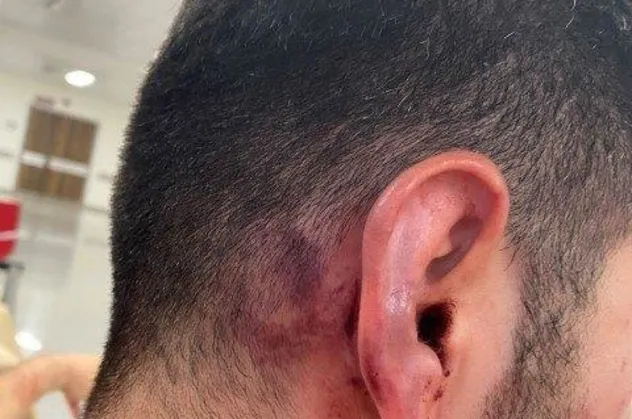 Ünlü futbolcu Veysel Sarı'nın kardeşinden kiracıya meydan dayağı! Burnunu kırdı kulağını patlattı