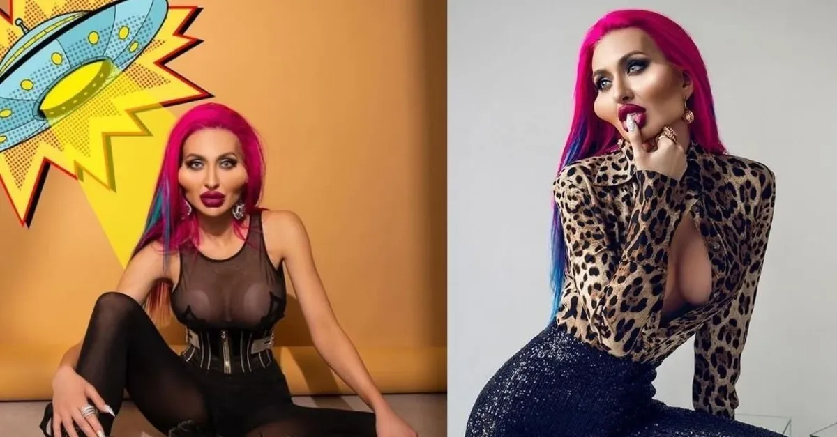 Tepkiler umrumda değil Dünyanın en büyük yanaklı kadını Anastasia Pokreshchuk yine dolgulandı! Ukraynalı influencer...