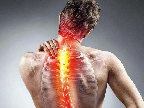 skolyoz-icin-cok-genc-1682369576508.jpeg Skolyoz için çok genç: Çocukluk çağından itibaren...-3